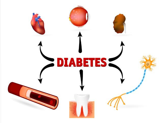 Type 1 Diabetes Mellitus Causes, Symptoms and Complications